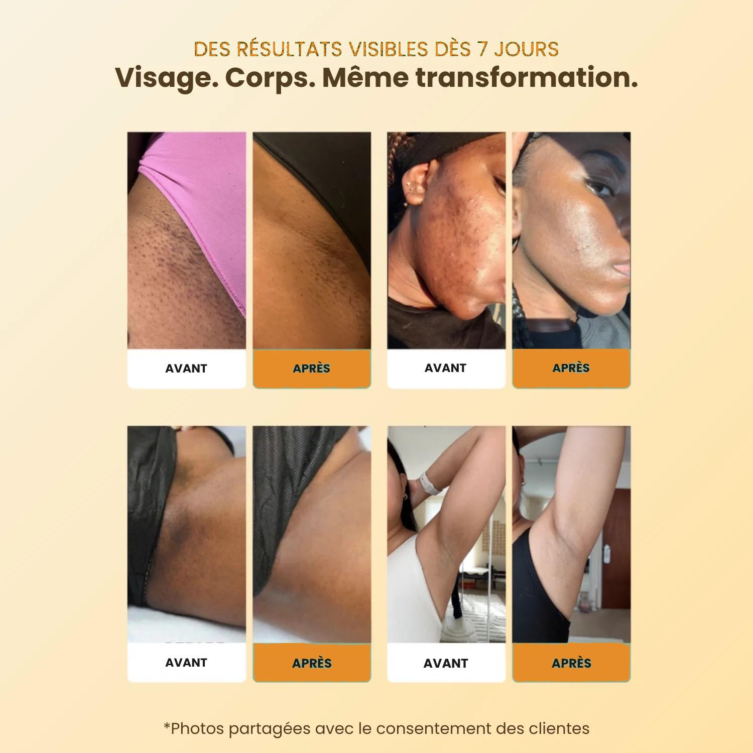 GlowKuma -Savon Anti-Taches au Curcuma